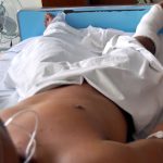 Cirurgia de amputação da perna de trabalhador acidentado em Frigorífico dura mais de 7h